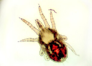 Bloedluis onder de microscoop